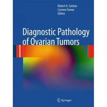 Diagnostic Pathology of Ovarian Tumors