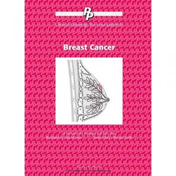 Patient Pictures: Breast Cancer: Clinical drawings for your patients.
