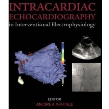 Intracardiac Echocardiography in Interventional Electrophysiology: Advanced Management of Atrial Fibrillation and Ventricular Tachycardia