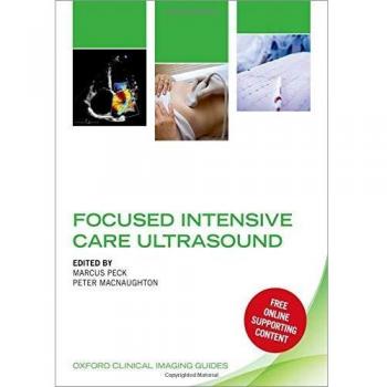 Focused Intensive Care Ultrasound