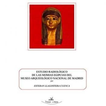 Estudio radiológico De Las momias egipcias Del Museo Arqueológico Nacional De Madrid
