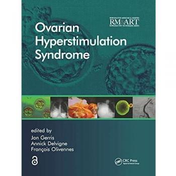 Ovarian Hyperstimulation Syndrome