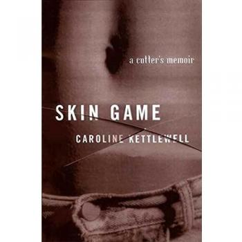 Skin Game: A Memoir of Resilience and Identity
