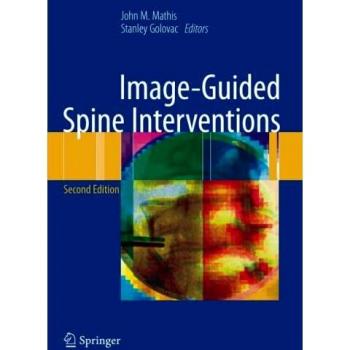 Image-Guided Spine Interventions