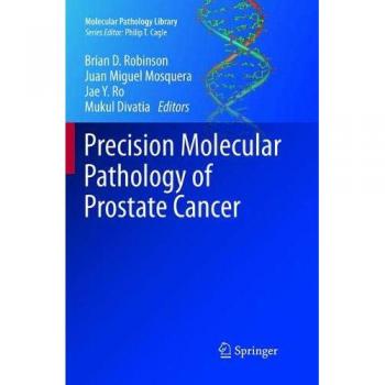 Precision Molecular Pathology of Prostate Cancer
