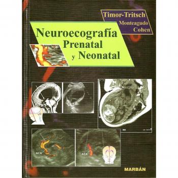Neuroecografía prenatal y neonatal