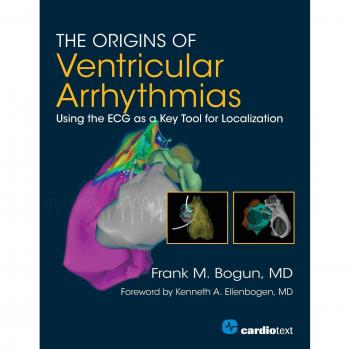 Ventricular Arrhythmias ECG Localization Guide