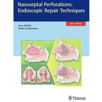 Nasoseptal Perforations: Endoscopic Repair Techniques