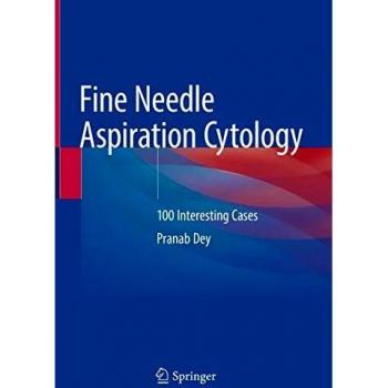 Fine Needle Aspiration Cytology: 100 Interesting Cases