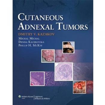 Cutaneous Adnexal Tumors