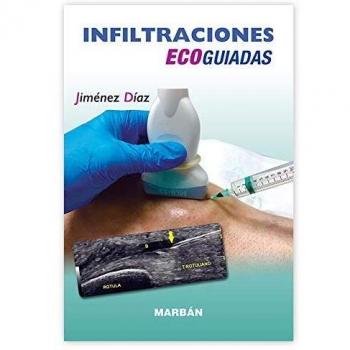 Infiltraciones Ecoguiadas