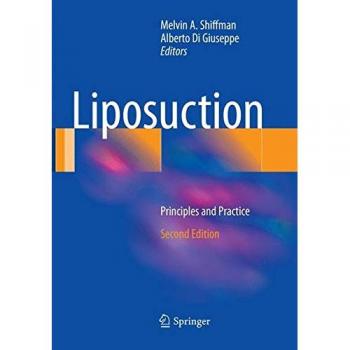 Liposuction: Principles and Practice