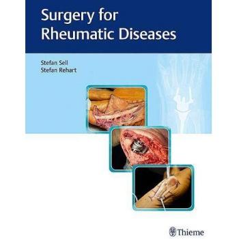 Surgery for Rheumatic Diseases