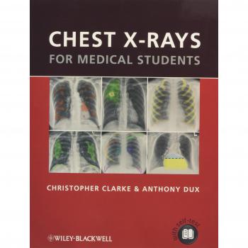 Chest X-rays for Medical Students