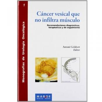 Cáncer vesical que no infiltra músculo