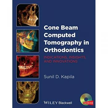 Cone Beam Computed Tomography in Orthodontics: Indications, Insights, and Innovations
