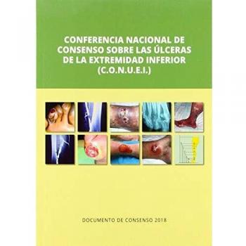 Conferencia Nacional de Consenso sobre las úlceras de la extremidad inferior