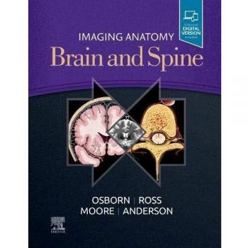 Anatomía por Imágenes del Cerebro y la Columna Vertebral: 1ra Edición