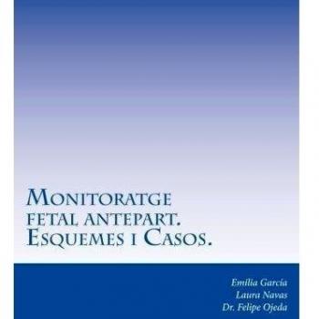 Monitoratge fetal antepart: Control del benestar fetal. Esquemes i casos