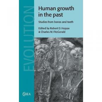 Crecimiento Humano en el Pasado: Estudios de Huesos y Dientes (Estudios de Cambridge en Antropología Biológica y Evolutiva, Volumen 25)