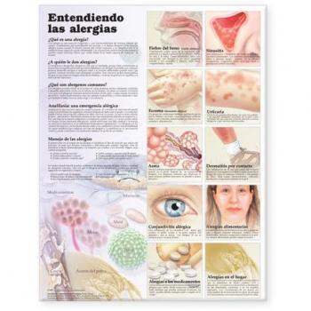 Understanding Allergies Anatomical Chart in Spanish