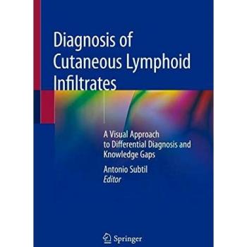 Diagnosis of Cutaneous Lymphoid Infiltrates: A Visual Approach to Differential Diagnosis and Knowledge Gaps
