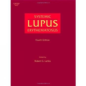 Systemic Lupus Erythematosus