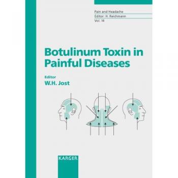 Botulinum Toxin in Painful Diseases