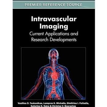 Intravascular Imaging: Current Applications and Research Developments