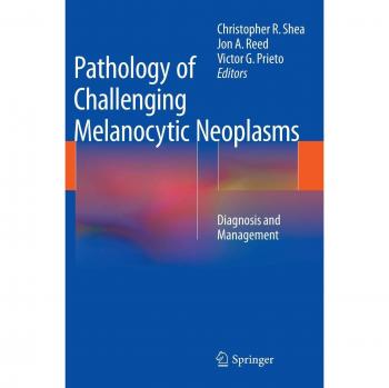 Challenging Melanocytic Neoplasms: Diagnosis and Management in Pathology