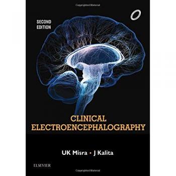 Clinical Electroencephalography, 2e