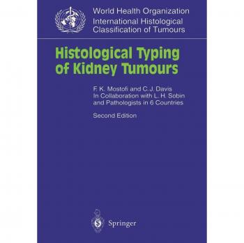 Histological Typing of Kidney Tumours