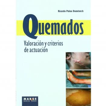 Quemados. Valoración y criterios de actuación: Valoración y criterios de actuación
