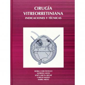 Cirugía Vitreorretiniana. Indicaciones Y Técnicas