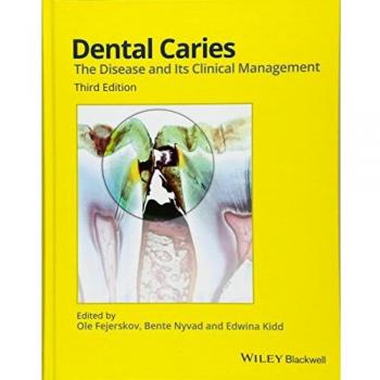 Dental Caries: The Disease And Its Clinical Mangement 3/E