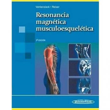Resonancia magnetica musculoesqueletica