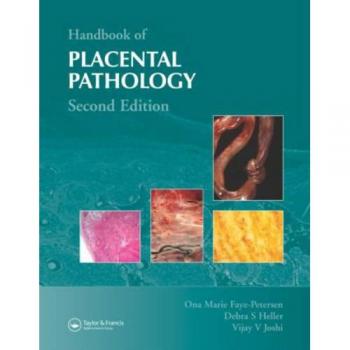 Comprehensive Guide to Placental Pathology (Hardback)