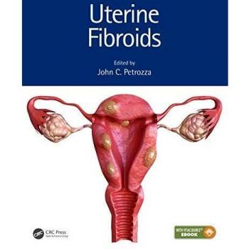 Uterine Fibroids