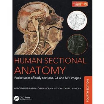Human Sectional Anatomy: Pocket atlas of body sections, CT and MRI images, Fourth edition