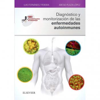 Diagnóstico y monitorización de las enfermedades autoinmunes