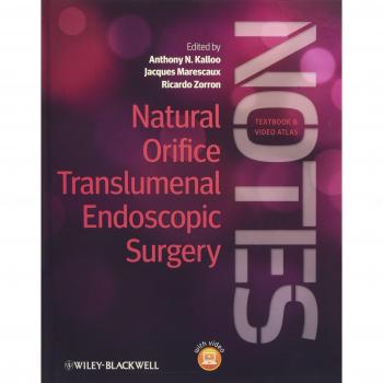 Natural Orifice Translumenal Endoscopic Surgery