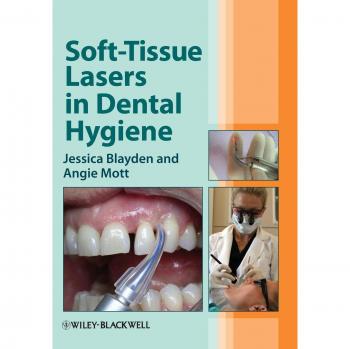 Soft-Tissue Lasers in Dental Hygiene