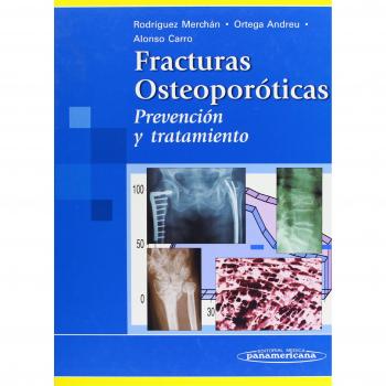 Fracturas Osteoporóticas. Prevención y Tratamiento