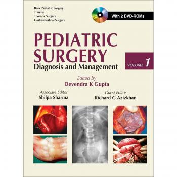 Pediatric Surgery: Diagnosis and Management