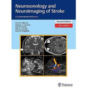 Comprehensive Reference on Neurosonology and Neuroimaging for Stroke