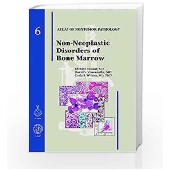 Non-Neoplastic Diseases of Bone Marrow: 6