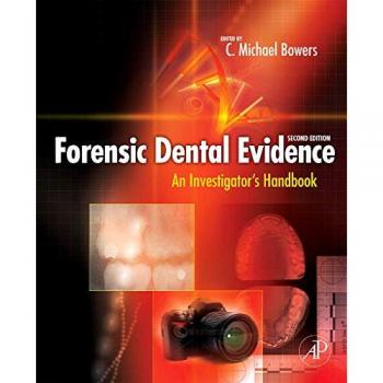 Forensic Dental Evidence: Comprehensive Investigator's Guide