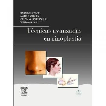 Técnicas avanzadas en rinoplastia