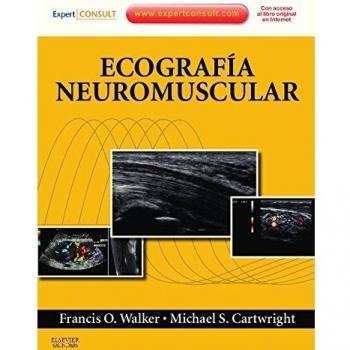 Ecografía neuromuscular