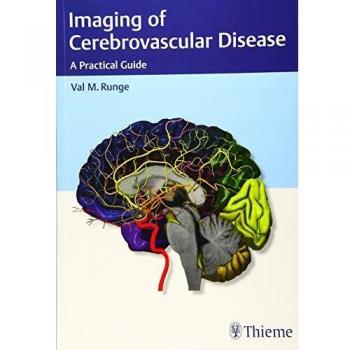 Imaging of Cerebrovascular Disease: A Practical Guide